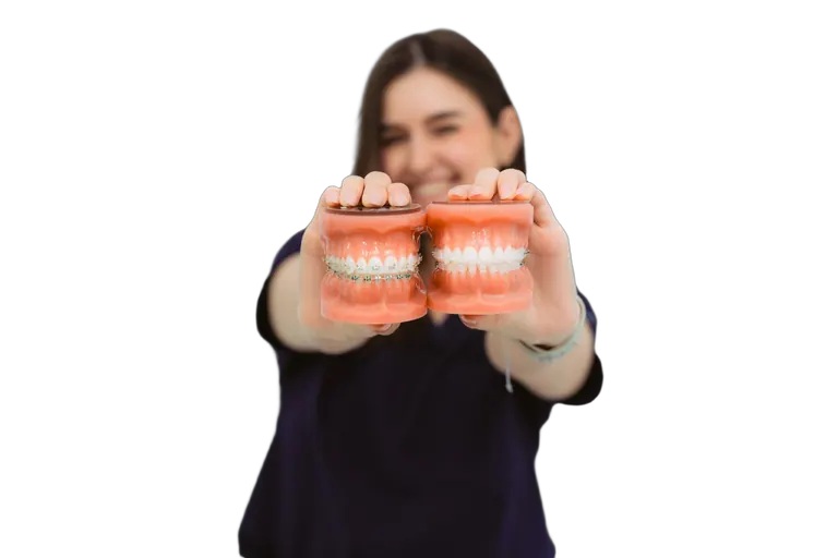 Modele dentare — aparat și dinți aliniați